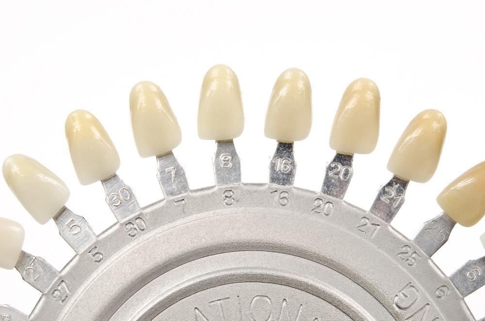 Different shade for tooth colored fillings in Eagan MN