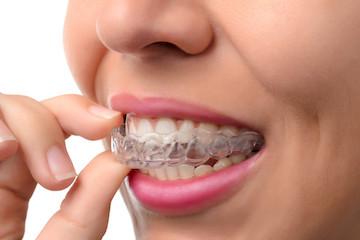 Woman putting on SureSmile aligners in Eagan MN