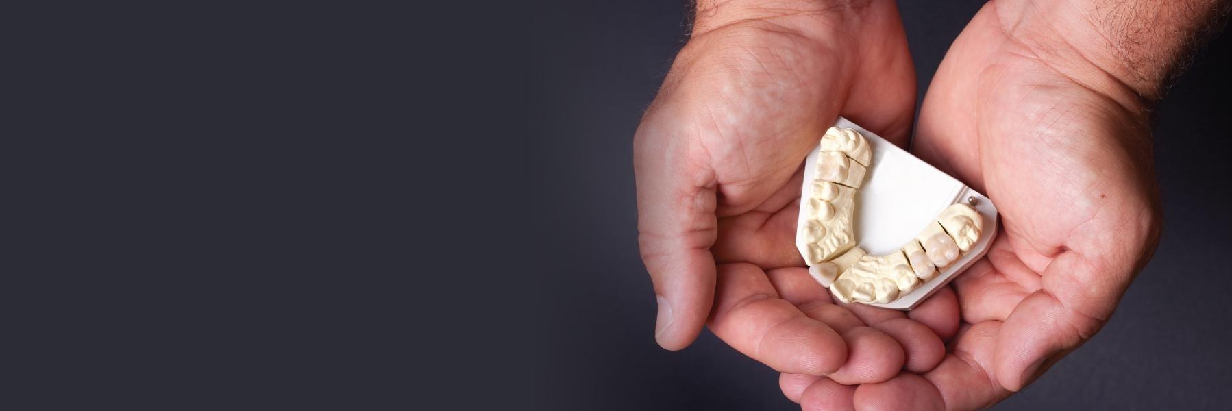 Hands open holding dentures at Eagan dentist office