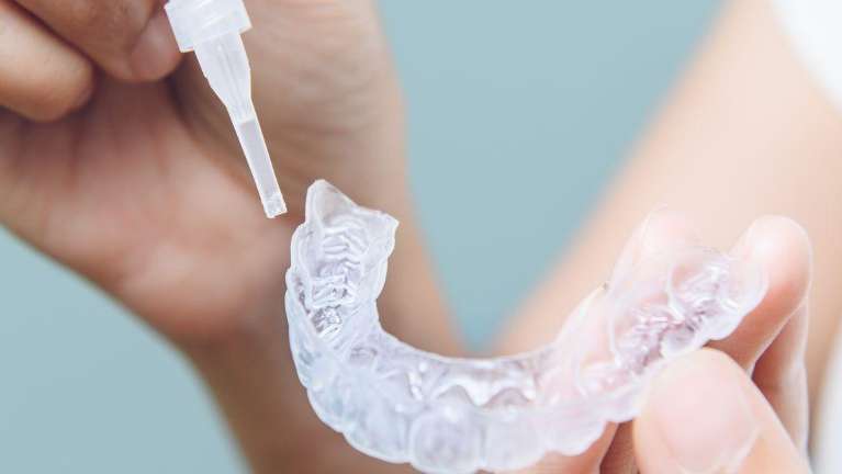 Opalescence teeth whitening in Eagan MN